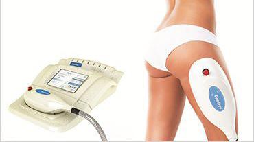 Lipocryo