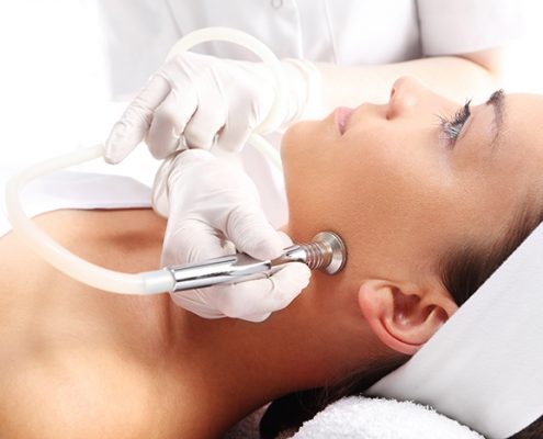 Microdermabrasie-4